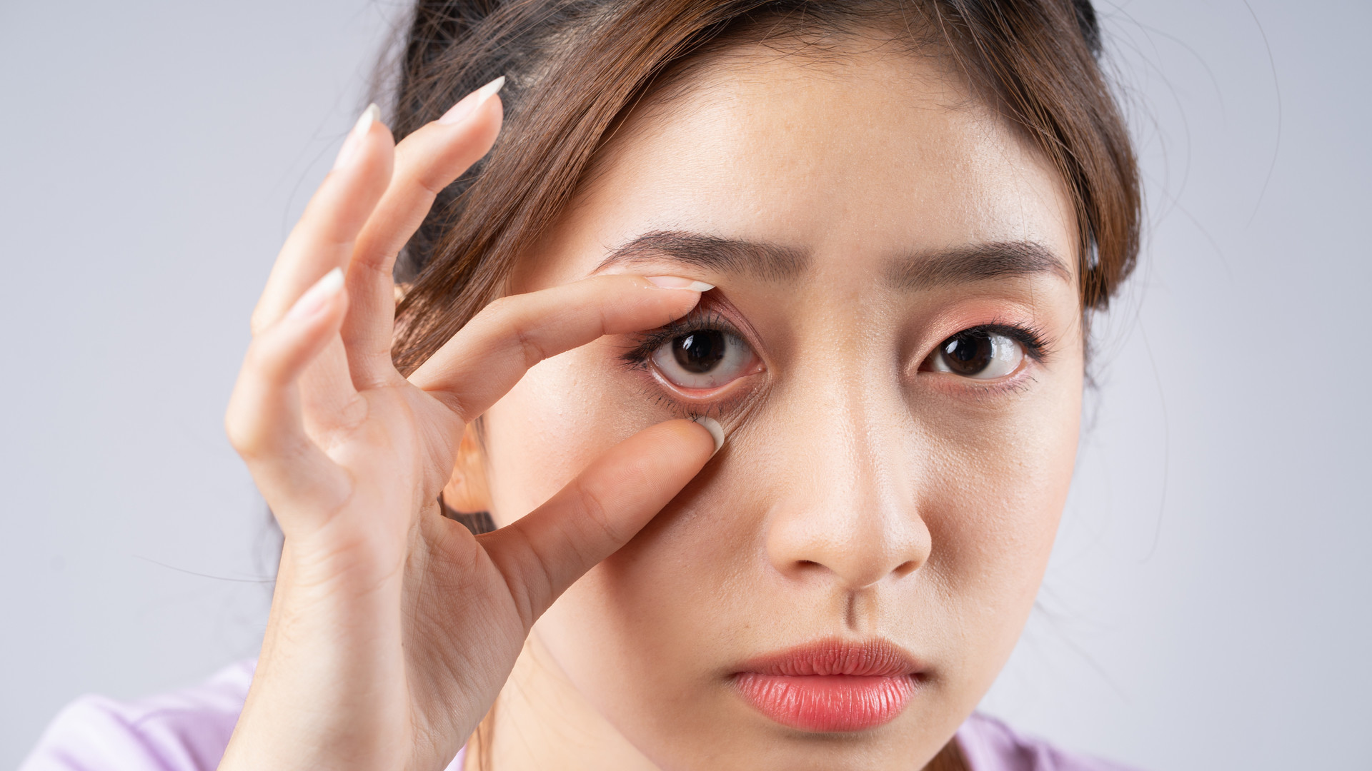 大小眼竟是「腦長瘤」？  眼瞼下垂只能手術？  專家：這兩類人不適合