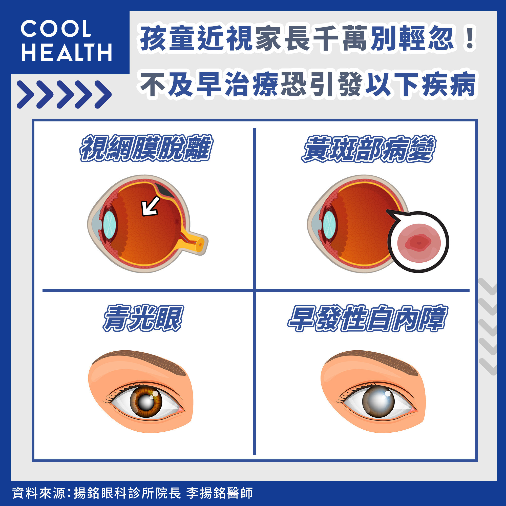 台灣近視率30年暴增2.4倍！  不及早治療恐引起青光眼、白內障