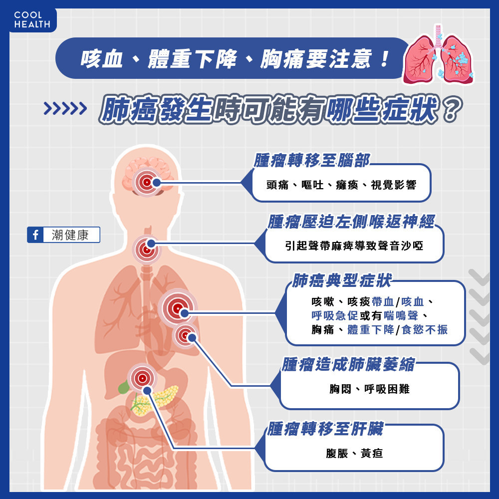肺癌早期沒有特異症狀  聲音沙啞呼吸急促要當心
