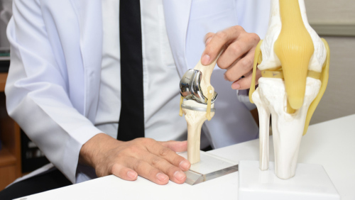 置換人工膝關節最怕手術失敗？  醫：導入機器手臂+精準切骨是趨勢